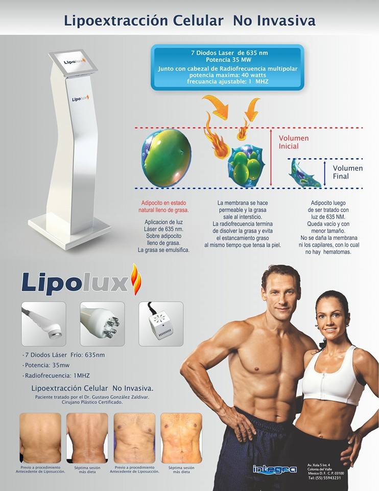 Lipoextraccion celular no invasiva 