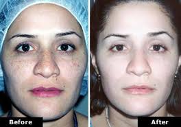 medicina-estetica-amelan-02