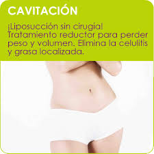 cavitacion2