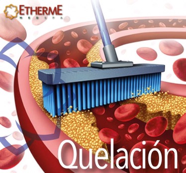 Que es la Terapia de Quelación